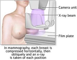 mammography_1_UConnHealthCenter